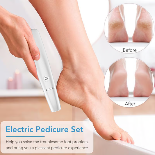 🌸Mother's Day Hot Sale 50%🌸Electric Feet Callus Remover🎁1 Replacement Head Included🎁