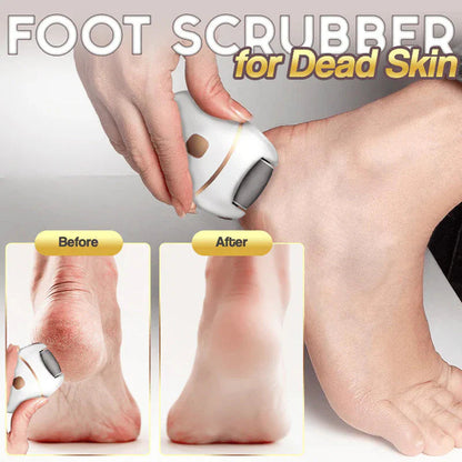 ⏳ Limited-Time 50% OFF! ⚡ Rechargeable Electric Foot File – Two Speeds, Removable Grinding Head & USB Charging 🦶✨
