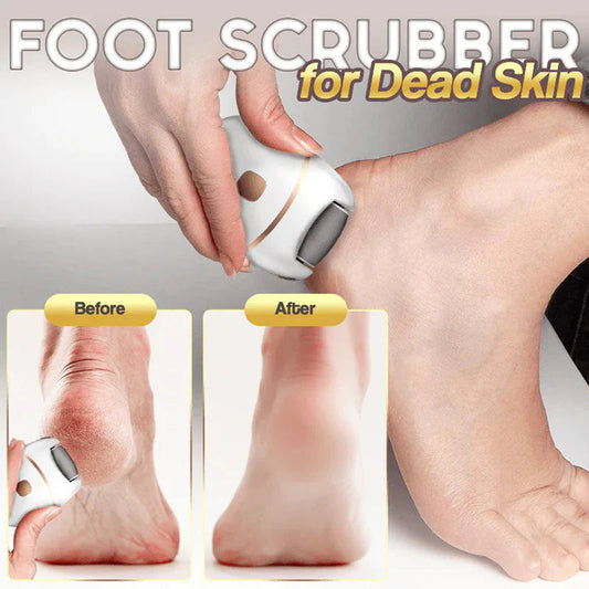 ⏳ Limited-Time 50% OFF! ⚡ Rechargeable Electric Foot File – Two Speeds, Removable Grinding Head & USB Charging 🦶✨