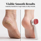 ⏰🔥 LAST DAY SALE 50% OFF (📦Buy 2 , Free Shipping)🏆 Double-Sided Foot Scraper – Easily Removes Calluses and Dead Skin ✨🦶